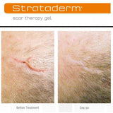 Strataderm Silicone Scar Therapy Gel 10g Soften & flatten Scars Reduces Itching