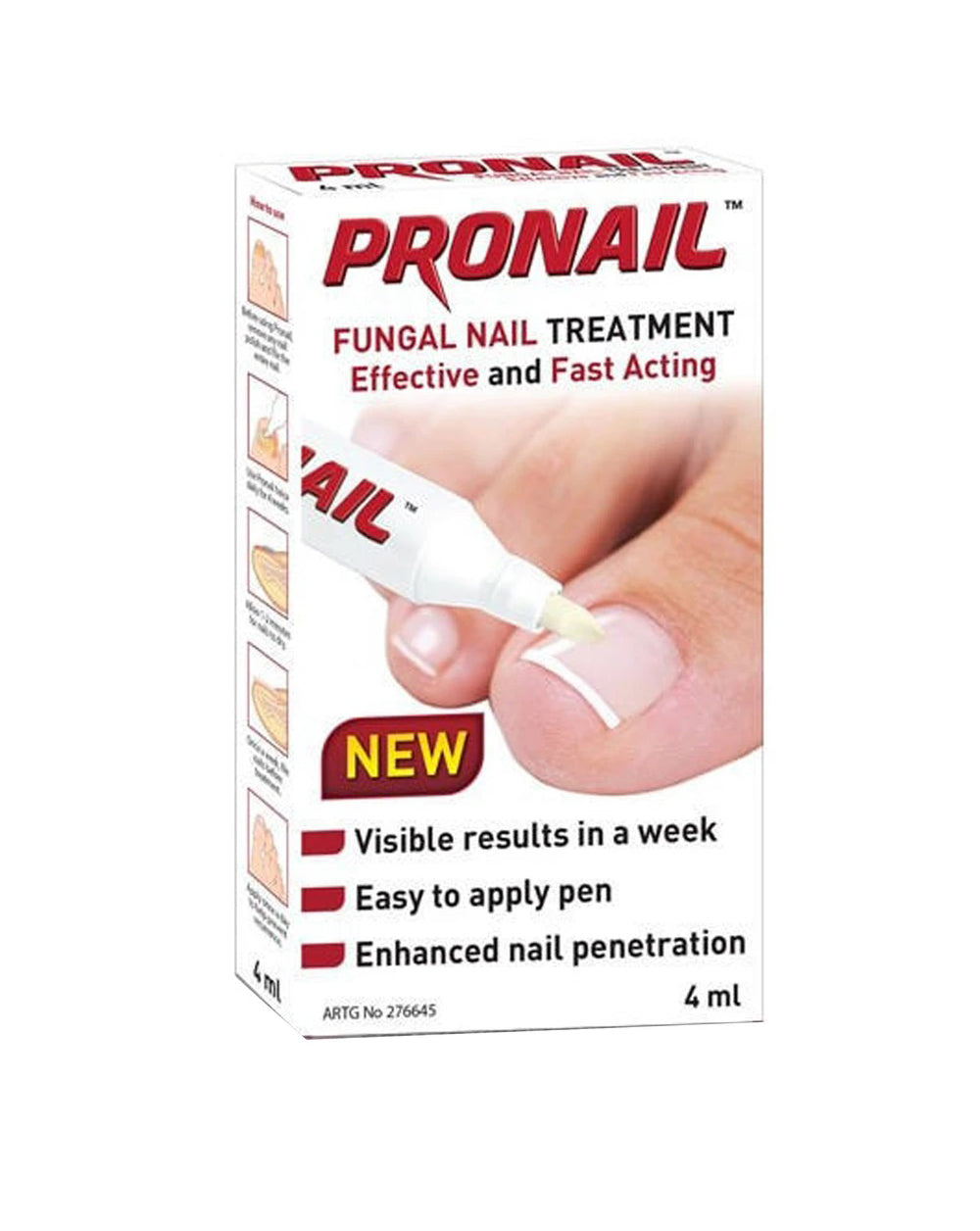 Fungal Nail Renewal, 0.33 fl oz (10 ml)